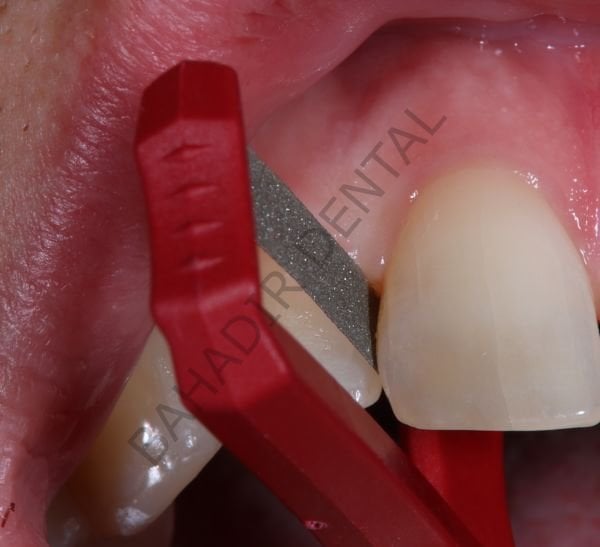 PAUL Serisi - Arayüz Zımpara Sistemi