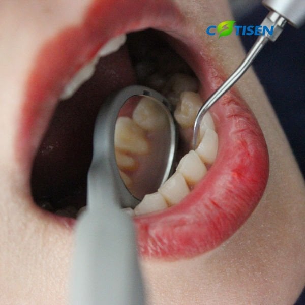 AeroView™ Aspirasyonlu Tedavi Aynası (50 Adet)