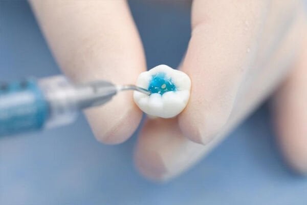 P-Etchant Fosforik Asit Etching Jel