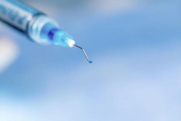 P-Etchant Fosforik Asit Etching Jel